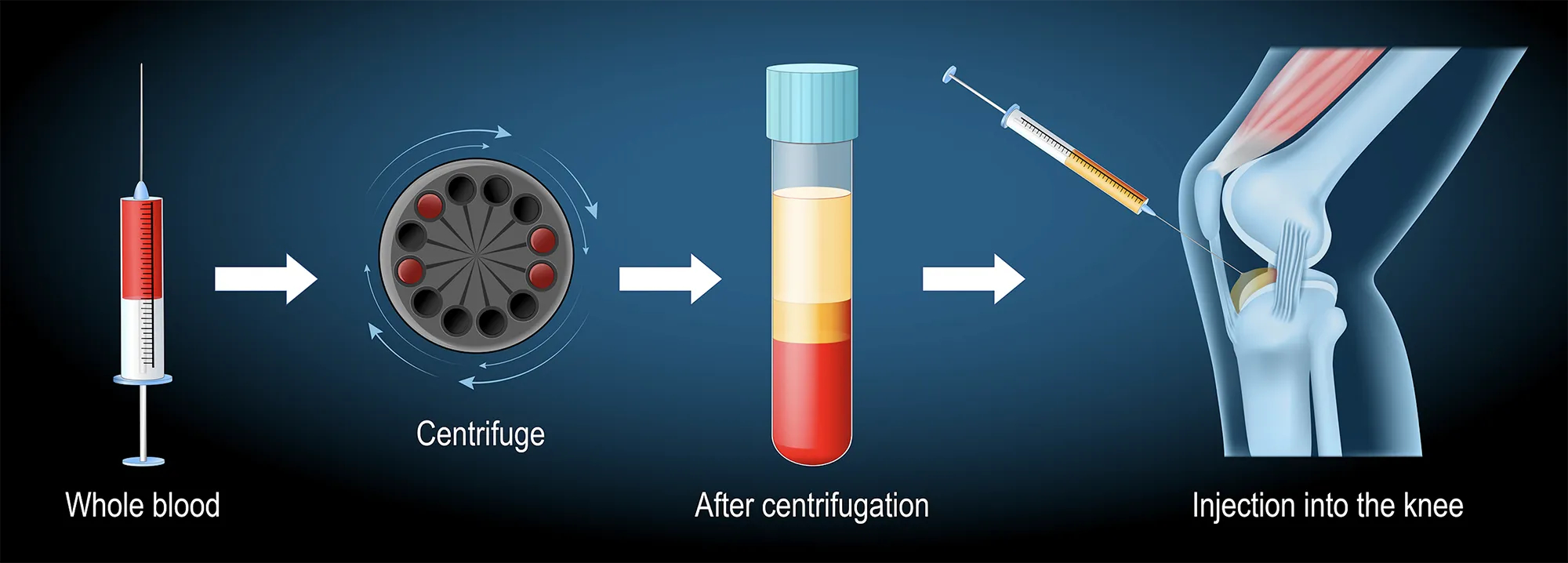 FOTOGRAFIA FACTORS