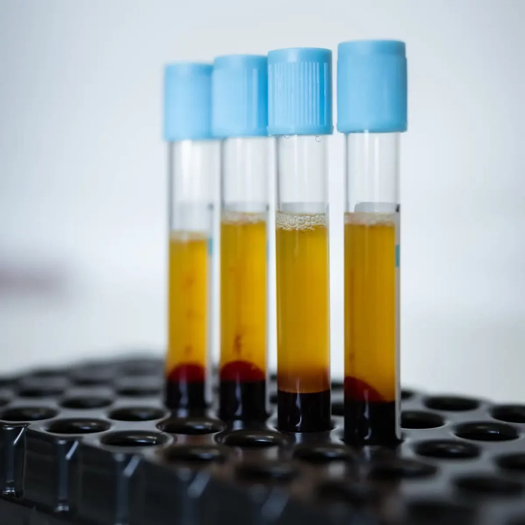 Tractaments biologics